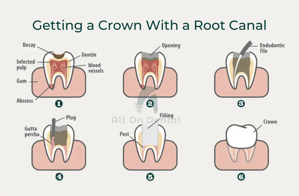 Crown Aftercare