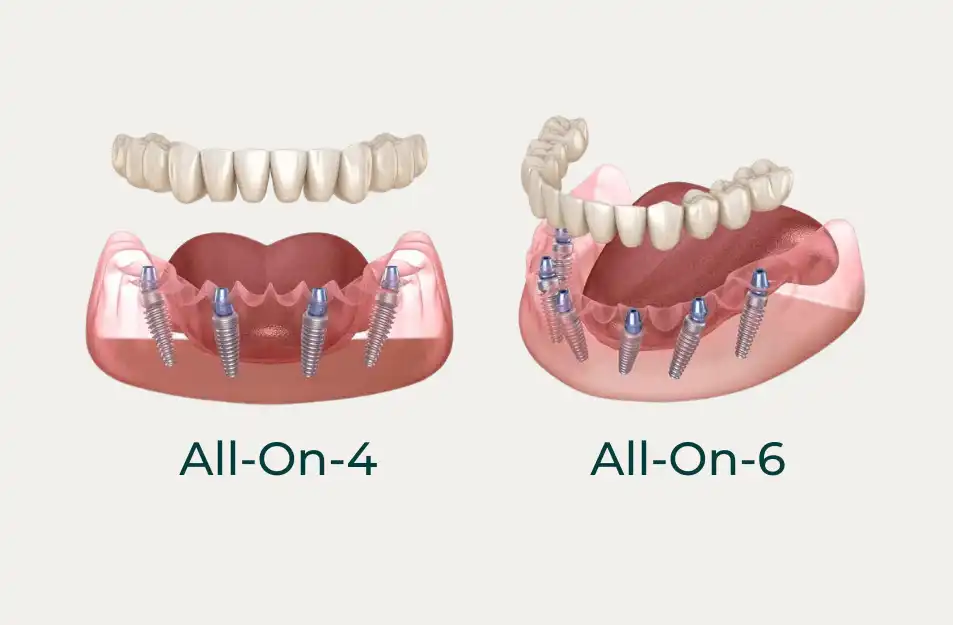 Dental Aftercare