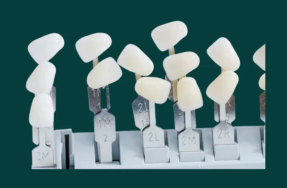 Veneers Shade Selection