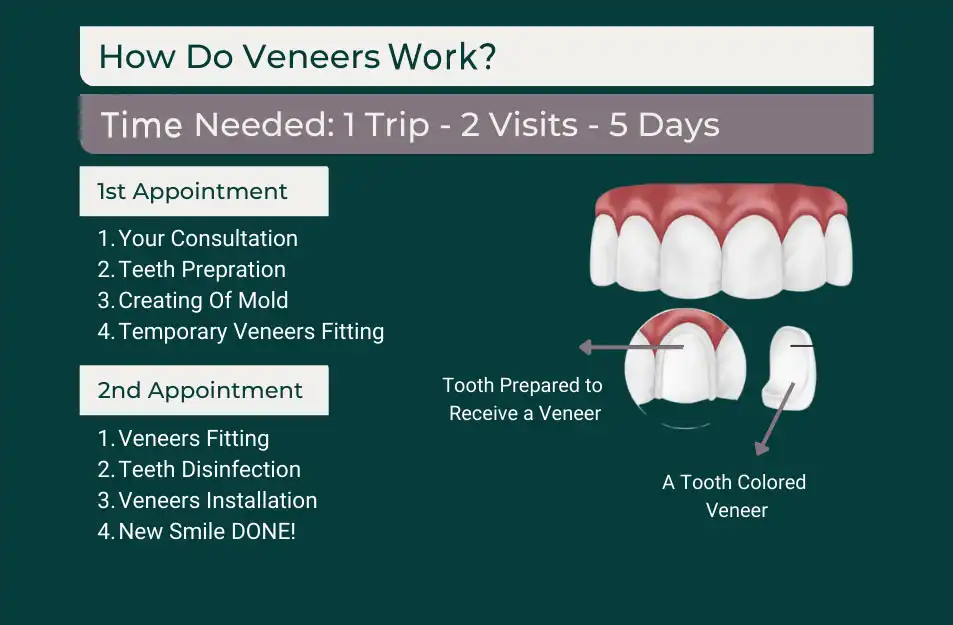 Veneers in Turkey