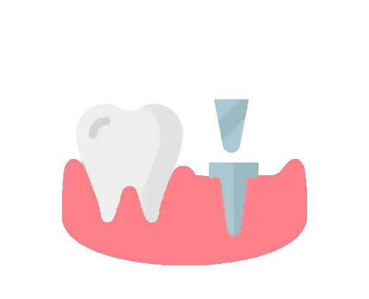Implantation