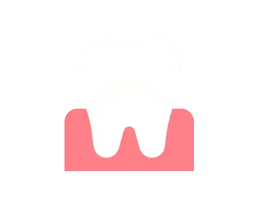 Dental Crowns